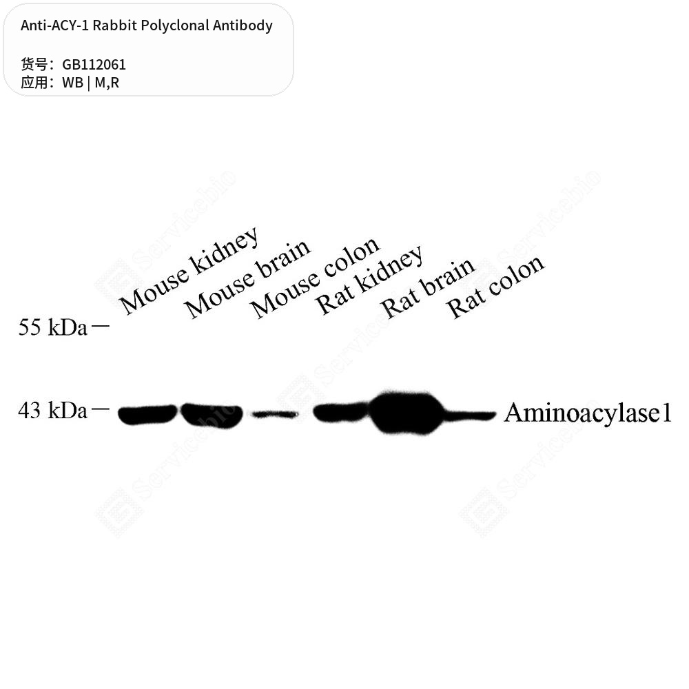 Антитела первичные, поликлональные кролика к ACY-1 крысы, мыши, 100 мкл