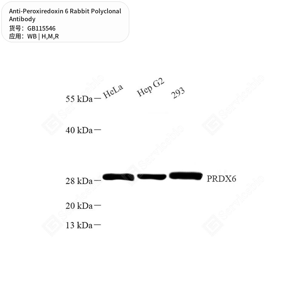 Антитела первичные, поликлональные кролика к Peroxiredoxin 6 крысы, мыши, человека, 50 мкл