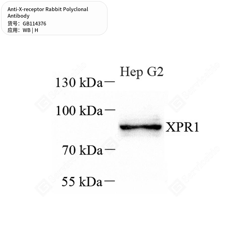 Антитела первичные, поликлональные кролика к X-receptor человека, 50 мкл