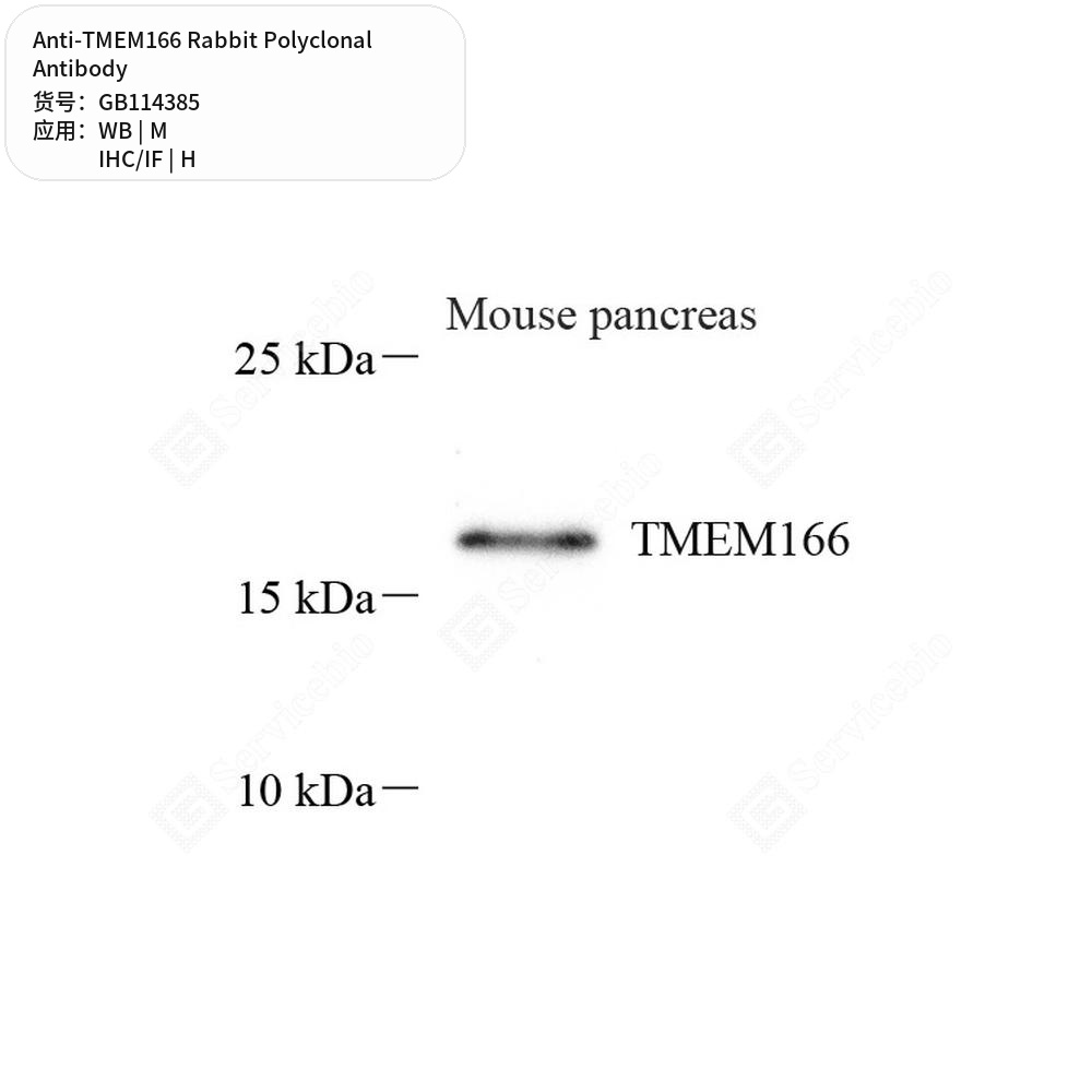Антитела первичные, поликлональные кролика к TMEM166 мыши, человека, 100 мкл