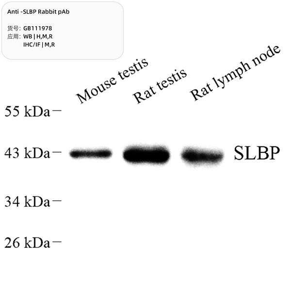 Антитела первичные, поликлональные, SLBP, 100 мкл