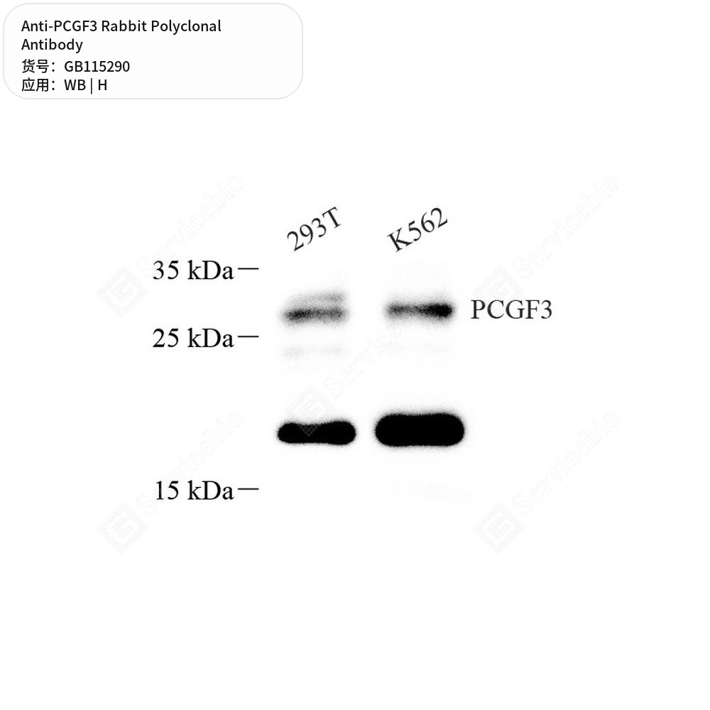 Антитела первичные, поликлональные кролика к PCGF3 человека, 100 мкл
