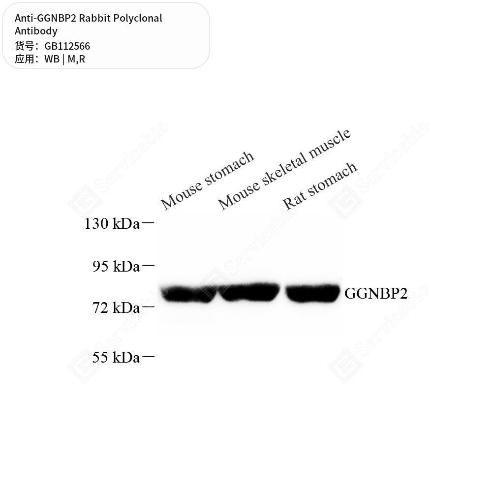 Антитела первичные, поликлональные кролика к GGNBP2 крысы, мыши, 100 мкл