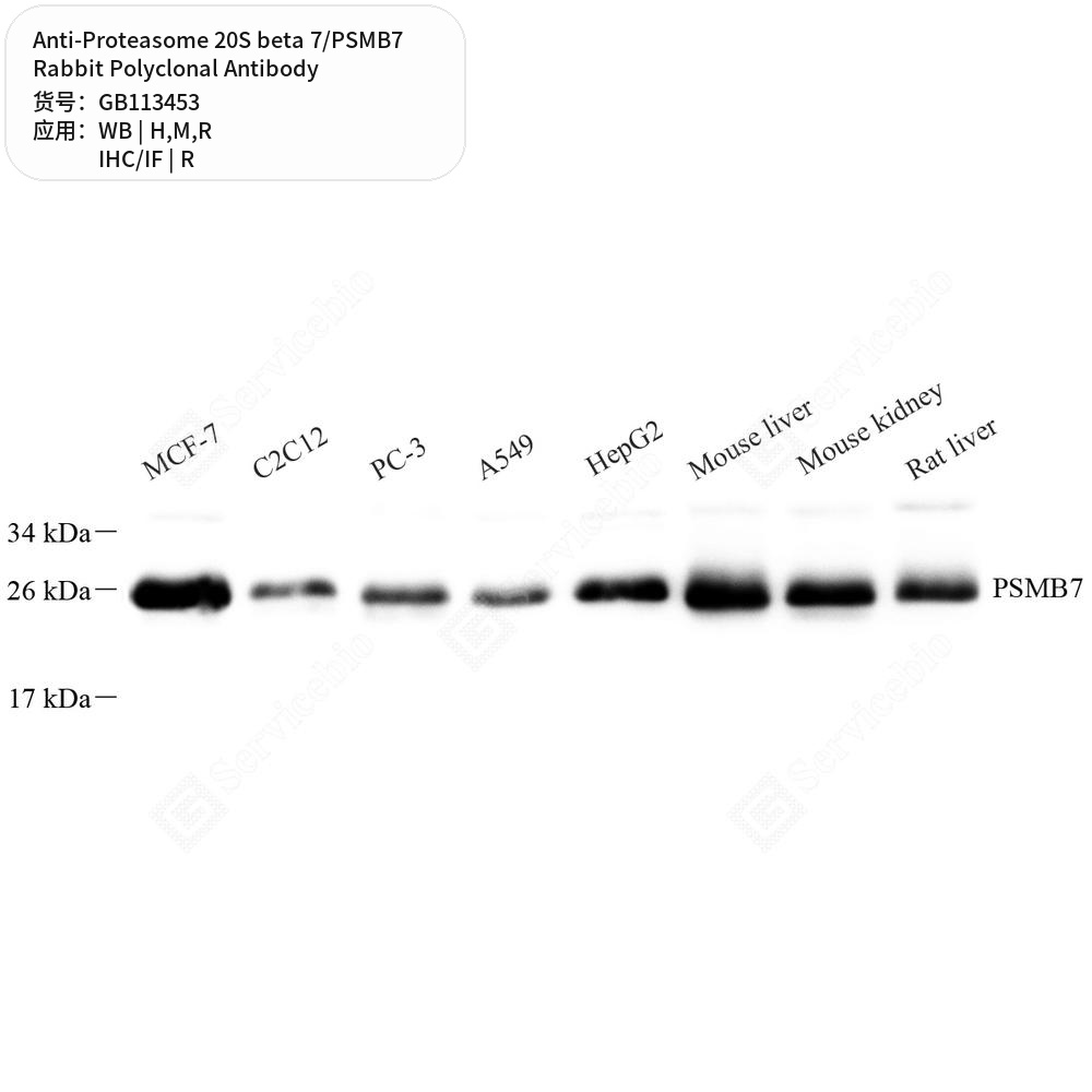 Антитела первичные, поликл. кролика к Proteasome 20S beta 7/PSMB7 крысы, мыши, человека, 100 мкл
