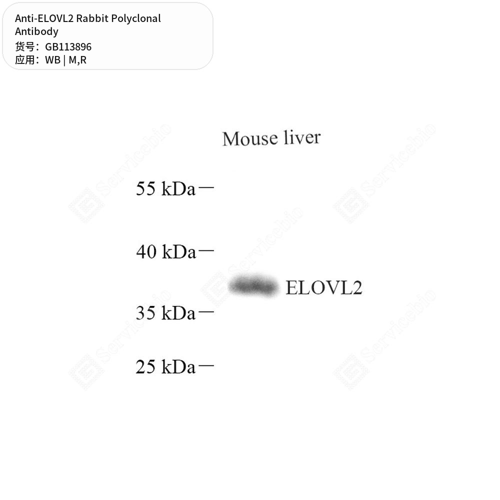 Антитела первичные, поликлональные кролика к ELOVL2 крысы, мыши, 100 мкл