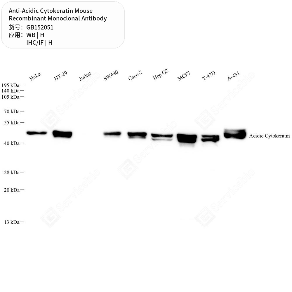 Антитела первичные, моноклональные мыши к Acidic Cytokeratin человека, 100 мкл