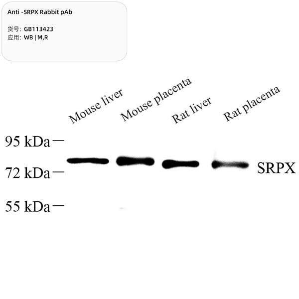Антитела первичные, поликлональные, SRPX, 100 мкл