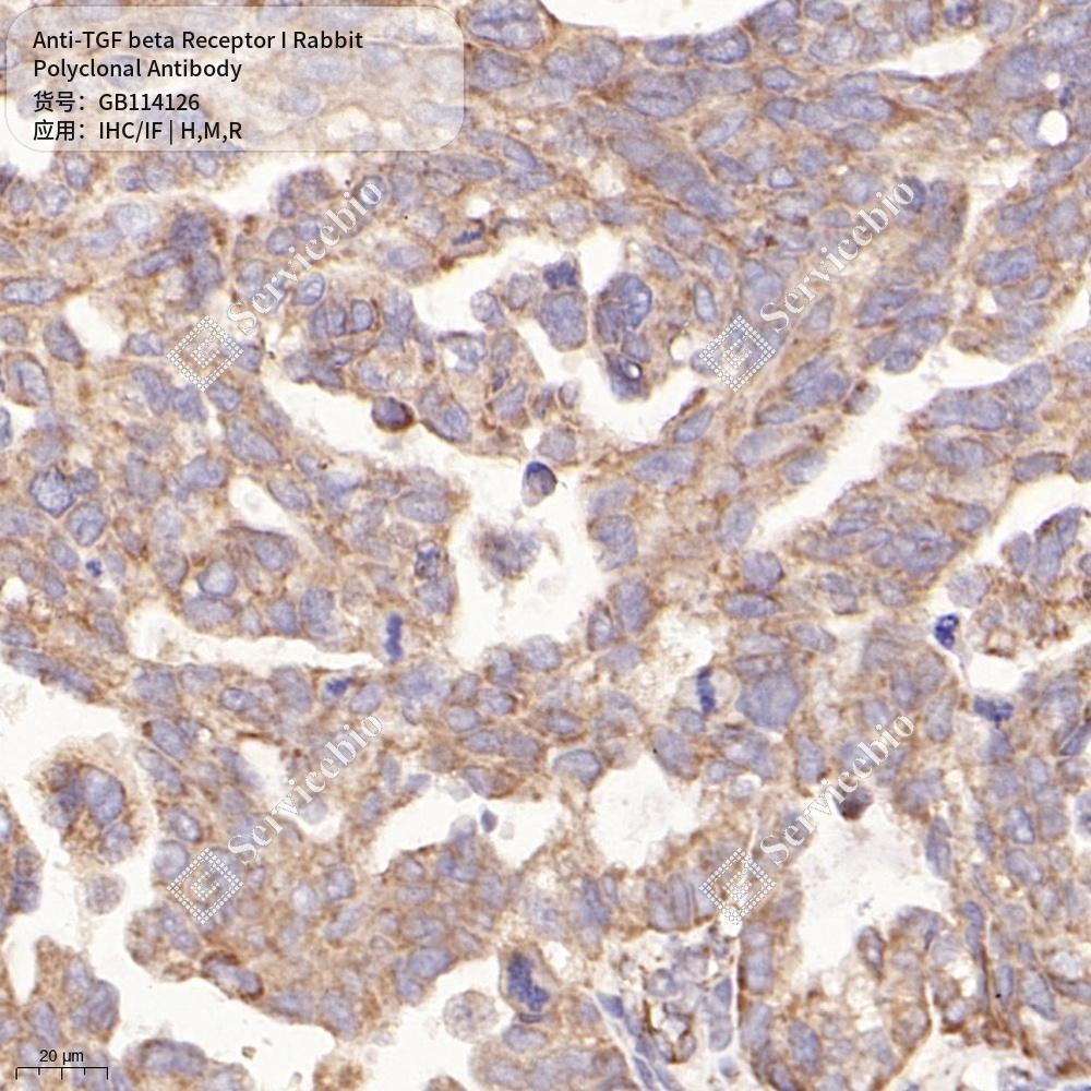 Антитела первичные, поликлональные кролика к TGF beta Receptor I крысы, мыши, человека, 100 мкл