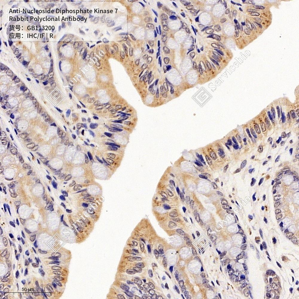Антитела первичные, поликлональные кролика к Nucleoside Diphosphate Kinase 7 крысы, 100 мкл