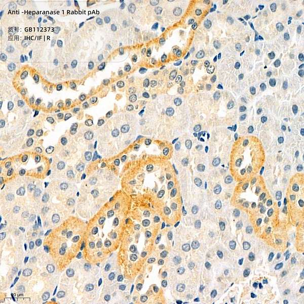 Антитела первичные, поликлональные, Heparanase 1, 100 мкл