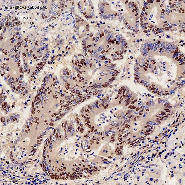 Антитела первичные, поликлональные, BRCA2, 100 мкл