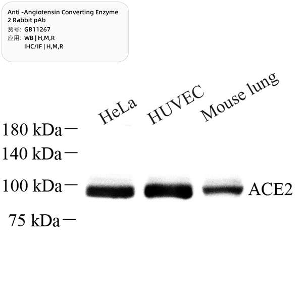 Антитела первичные, поликлональные, Angiotensin Converting Enzyme 2, 50 мкл