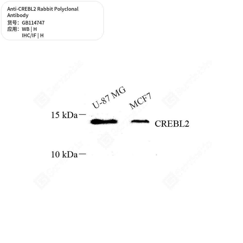 Антитела первичные, поликлональные кролика к CREBL2 человека, 100 мкл