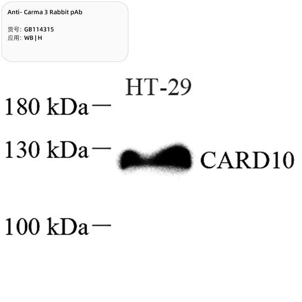 Антитела первичные, поликлональные, Carma 3, 100 мкл