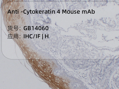 Антитела первичные, моноклональные мыши к Cytokeratin 4 человека, 50 мкл