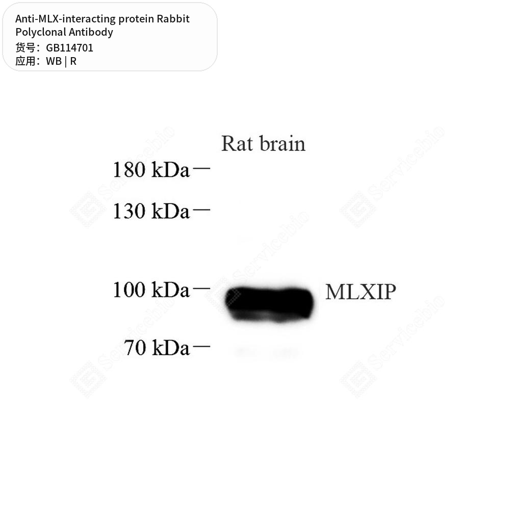 Антитела первичные, поликлональные кролика к MLX-interacting protein крысы, 100 мкл