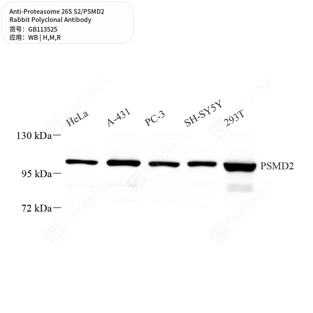 Антитела первичные, поликлональные кролика к Proteasome 26S S2/PSMD2 крысы, мыши, человека, 100 мкл