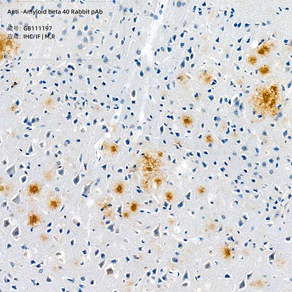 Антитела первичные, поликлональные, Amyloid beta 40, 100 мкл