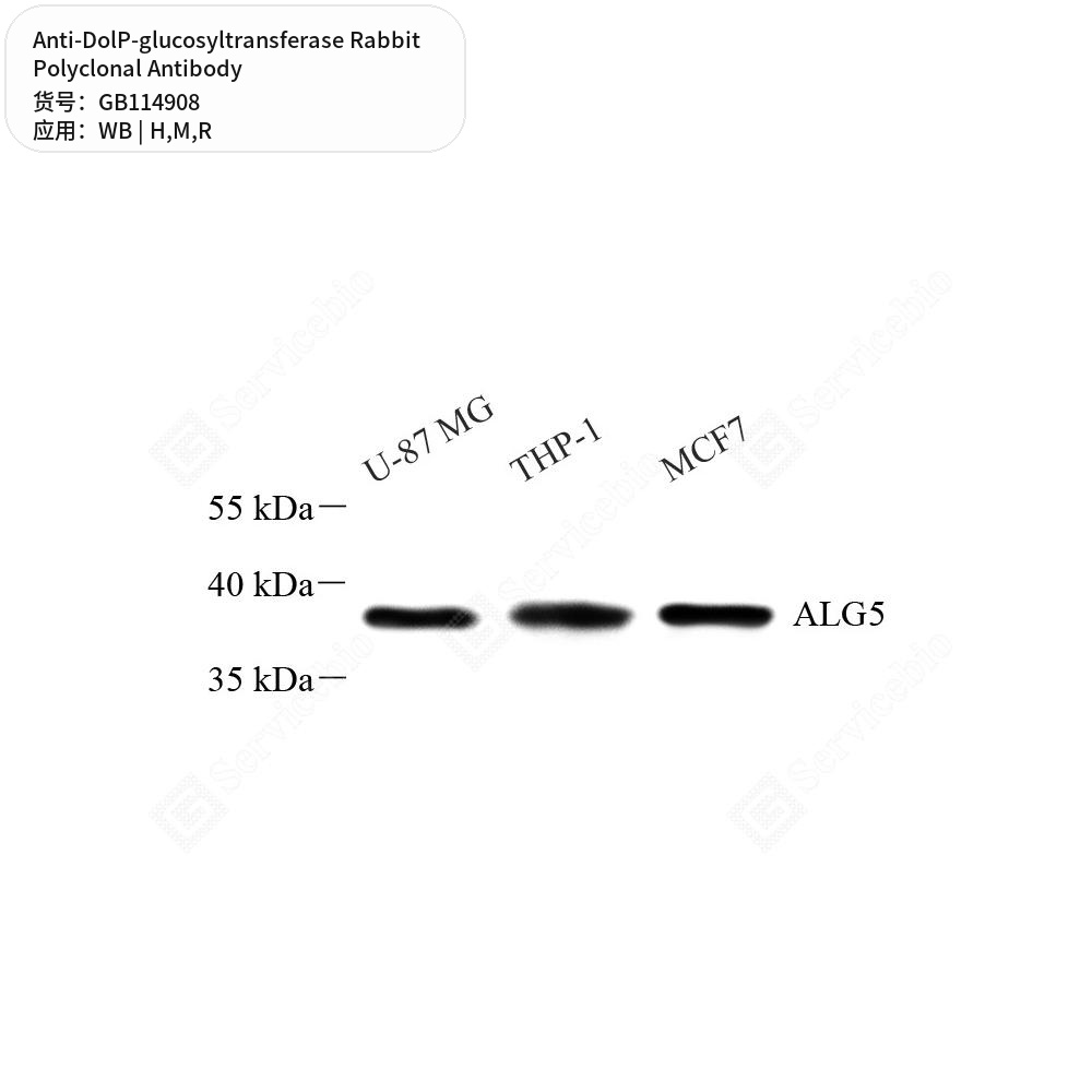 Антитела первичные, поликлональные кролика к DolP-glucosyltransferase крысы, мыши, человека, 50 мкл