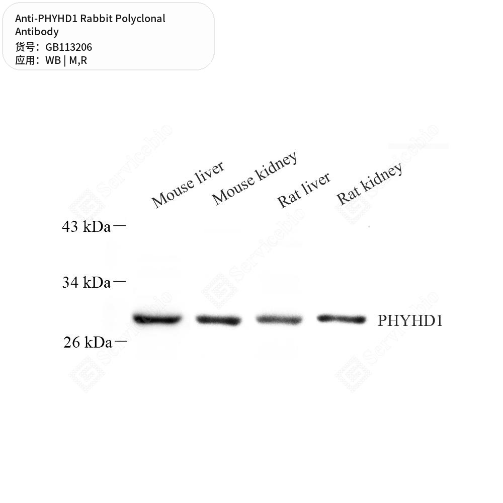 Антитела первичные, поликлональные кролика к PHYHD1 крысы, мыши, 50 мкл