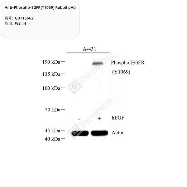 Антитела первичные, поликлональные, Phospho-EGFR(Y1069), 100 мкл