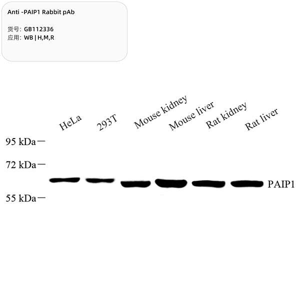 Антитела первичные, поликлональные, PAIP1, 100 мкл