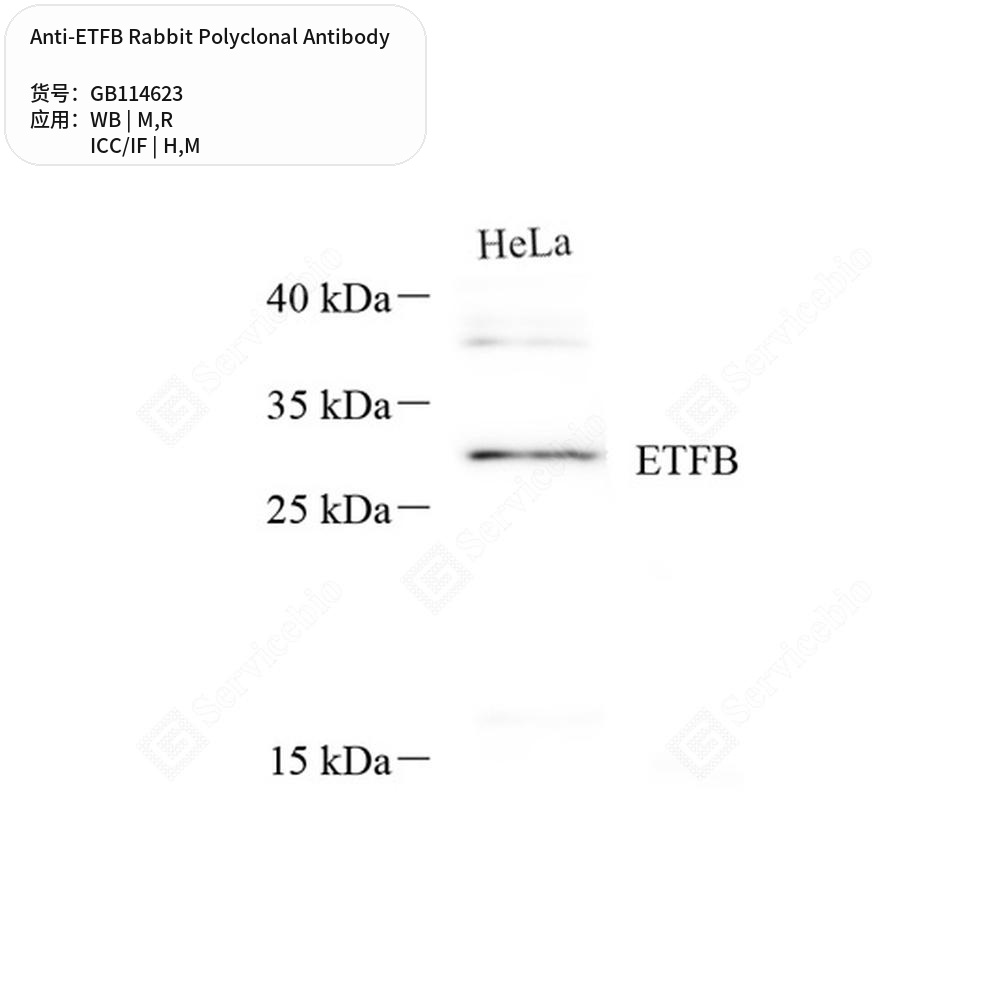 Антитела первичные, поликлональные кролика к ETFB крысы, мыши, человека, 100 мкл