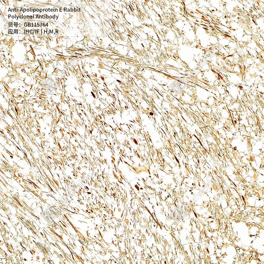 Антитела первичные, поликлональные кролика к Apolipoprotein E крысы, мыши, человека, 50 мкл