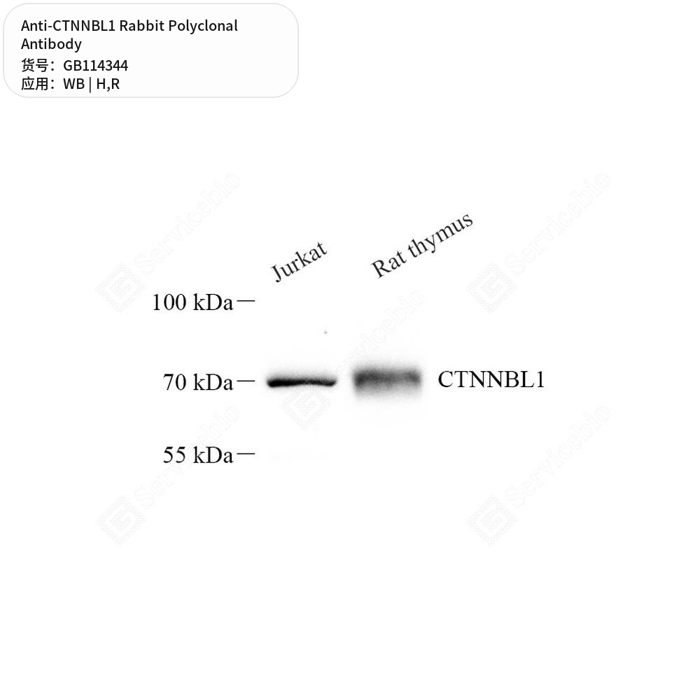 Антитела первичные, поликлональные кролика к CTNNBL1 крысы, человека, 100 мкл