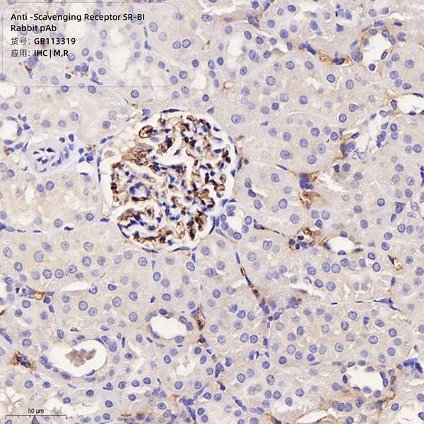 Антитела первичные, поликлональные, Scavenging Receptor SR-BI, 100 мкл