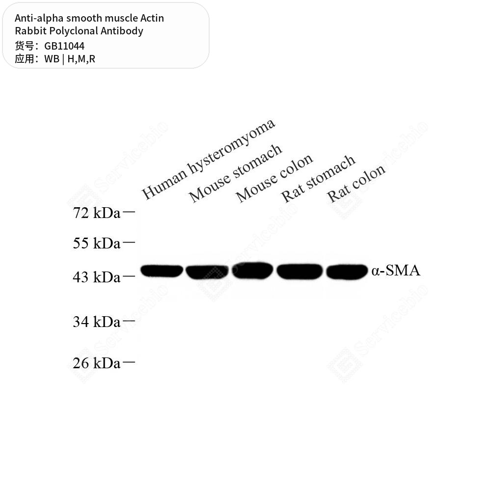 Антитела первичные, поликл. кролика к alpha smooth muscle Actin крысы, мыши, человека, 100 мкл