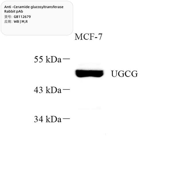 Антитела первичные, поликлональные, Ceramide glucosyltransferase, 100 мкл