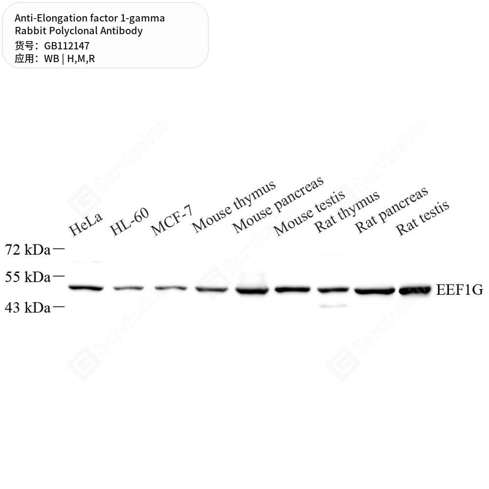 Антитела первичные, поликл. кролика к Elongation factor 1-gamma крысы, мыши, человека, 100 мкл
