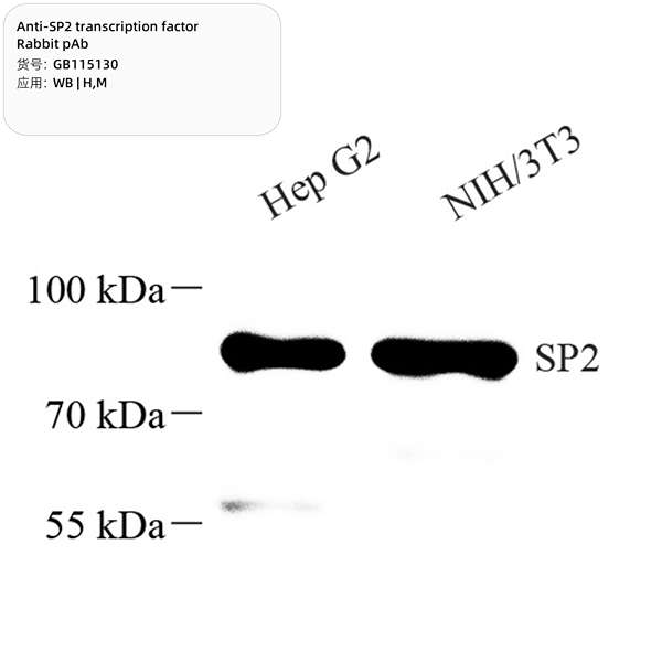 Антитела первичные, поликлональные, SP2 transcription factor, 100 мкл