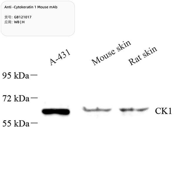 Антитела первичные, моноклональные, Cytokeratin 1, 100 мкл