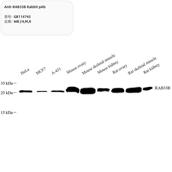 Антитела первичные, поликлональные, RAB33B, 100 мкл