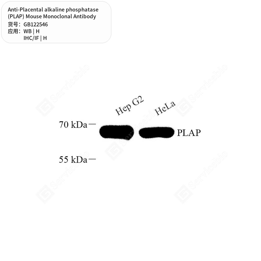 Антитела первичные, моноклональные мыши к Placental alkaline phosphatase (PLAP) человека, 50 мкл