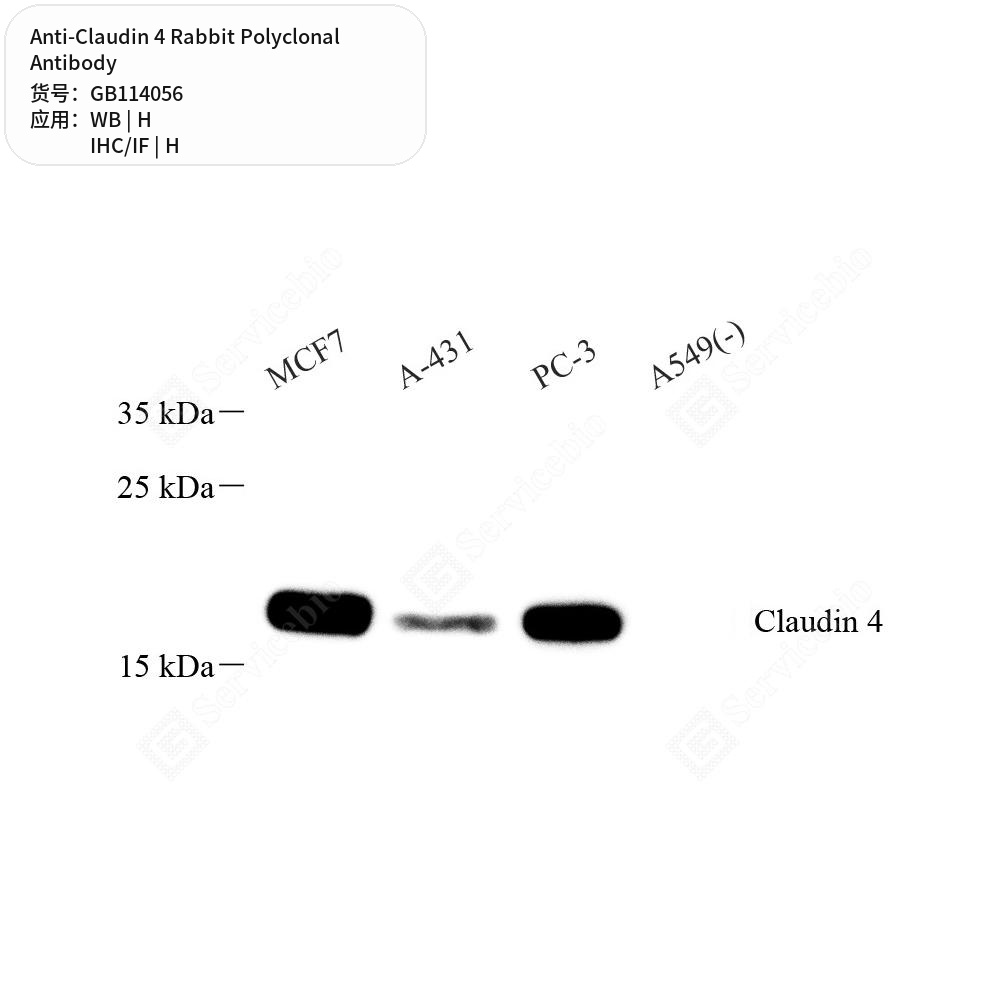 Антитела первичные, поликлональные кролика к Claudin 4 человека, 100 мкл