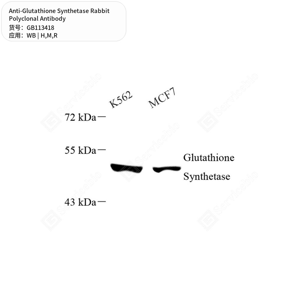 Антитела первичные, поликлональные кролика к Glutathione Synthetase крысы, мыши, человека, 100 мкл