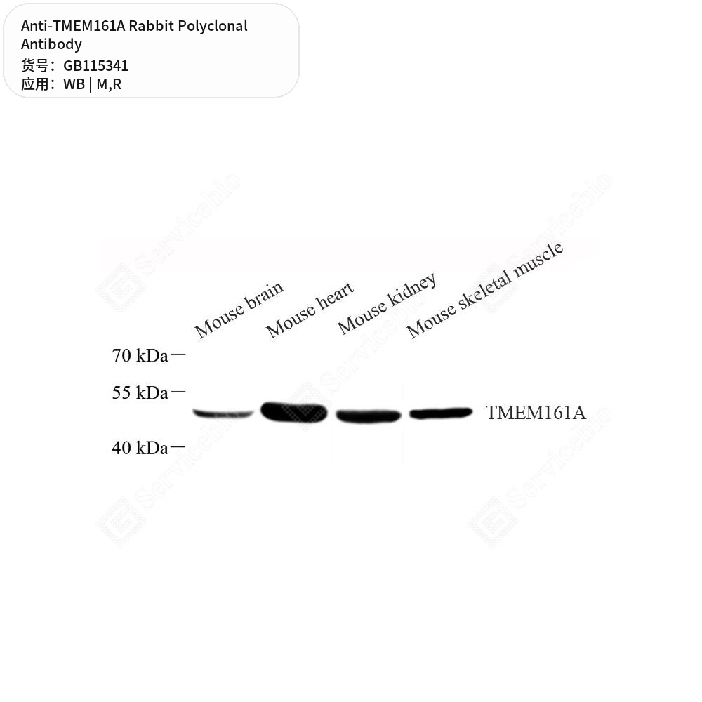 Антитела первичные, поликлональные кролика к TMEM161A крысы, мыши, 100 мкл