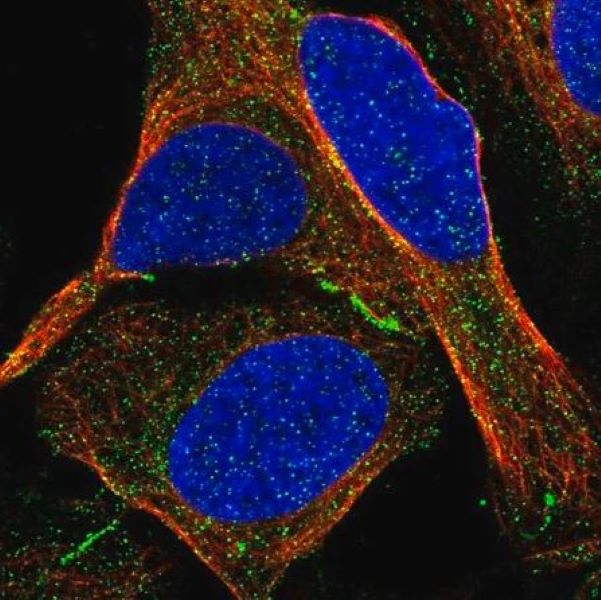 Антитела первичные, поликлональные KIAA1462, 100 мкл