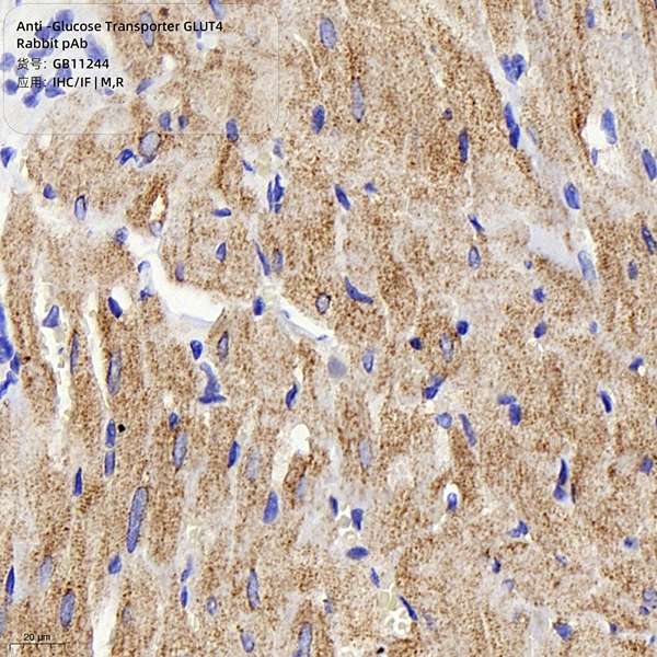 Антитела первичные, поликлональные, Glucose Transporter GLUT4, 100 мкл