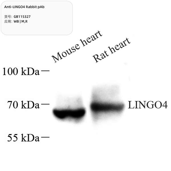 Антитела первичные, поликлональные, LINGO4, 100 мкл