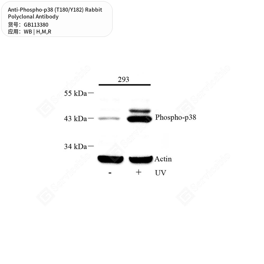Антитела первичные, поликлональные кролика к Phospho-p38 (T180/Y182) крысы, мыши, человека, 50 мкл