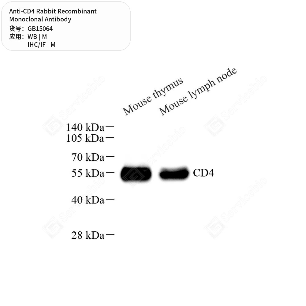 Антитела первичные, моноклональные кролика к CD4 мыши, 50 мкл