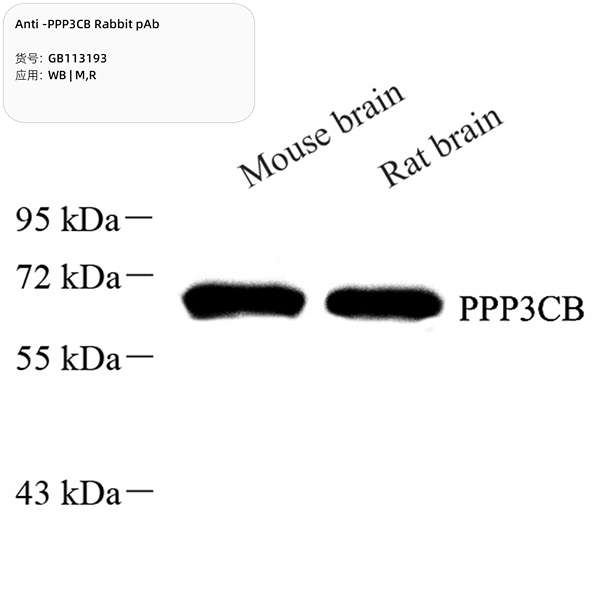 Антитела первичные, поликлональные, PPP3CB, 100 мкл