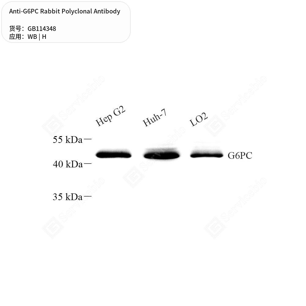 Антитела первичные, поликлональные кролика к G6PC человека, 50 мкл