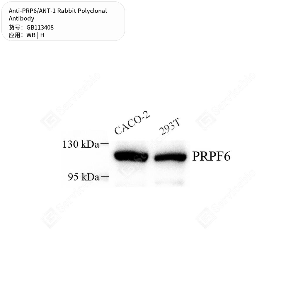 Антитела первичные, поликлональные кролика к PRP6/ANT-1 человека, 100 мкл