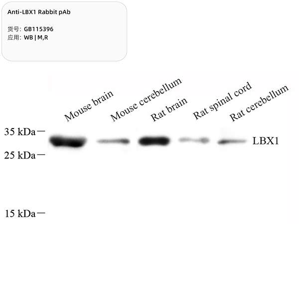 Антитела первичные, поликлональные, LBX1, 100 мкл