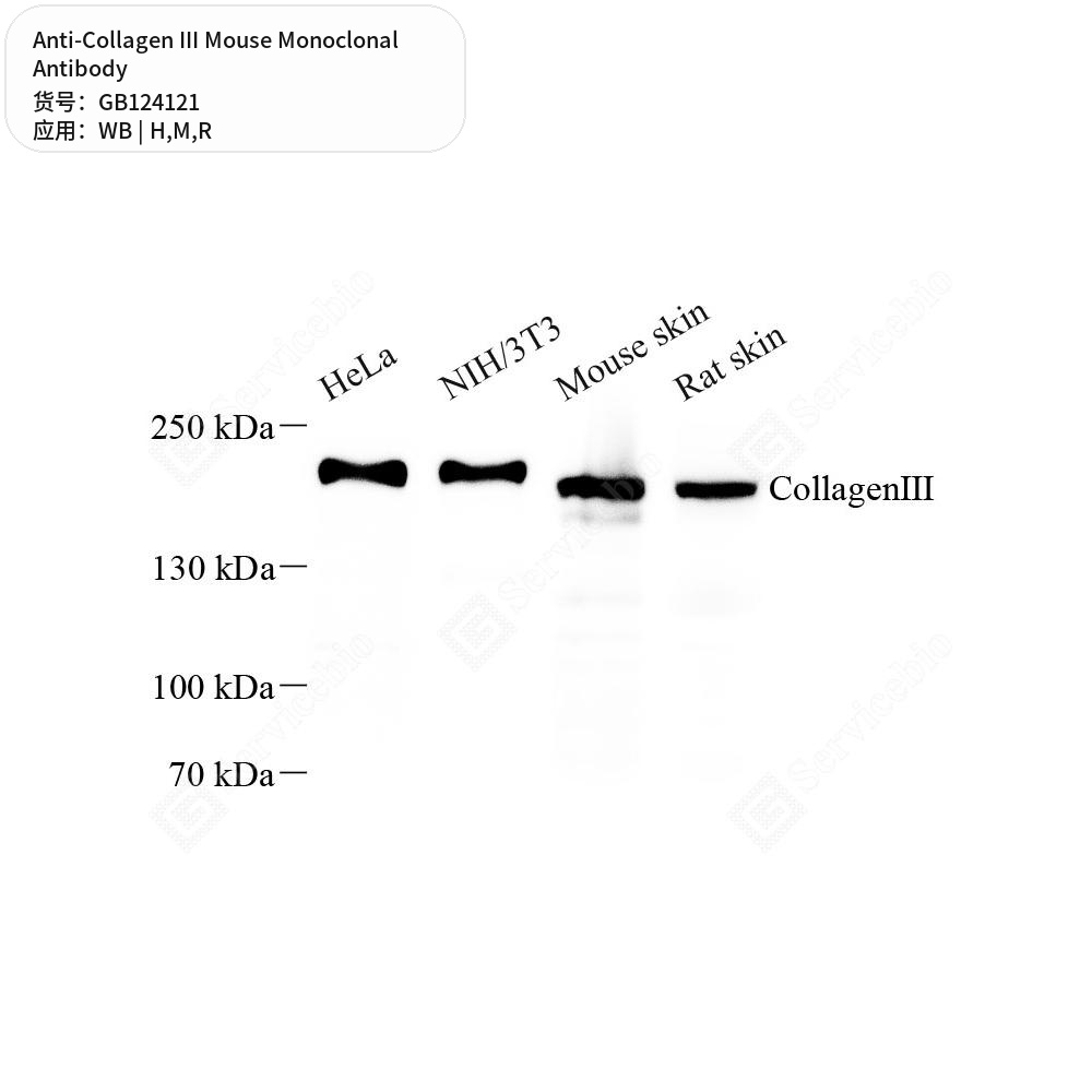Антитела первичные, моноклональные мыши к Collagen III крысы, мыши, человека, 50 мкл